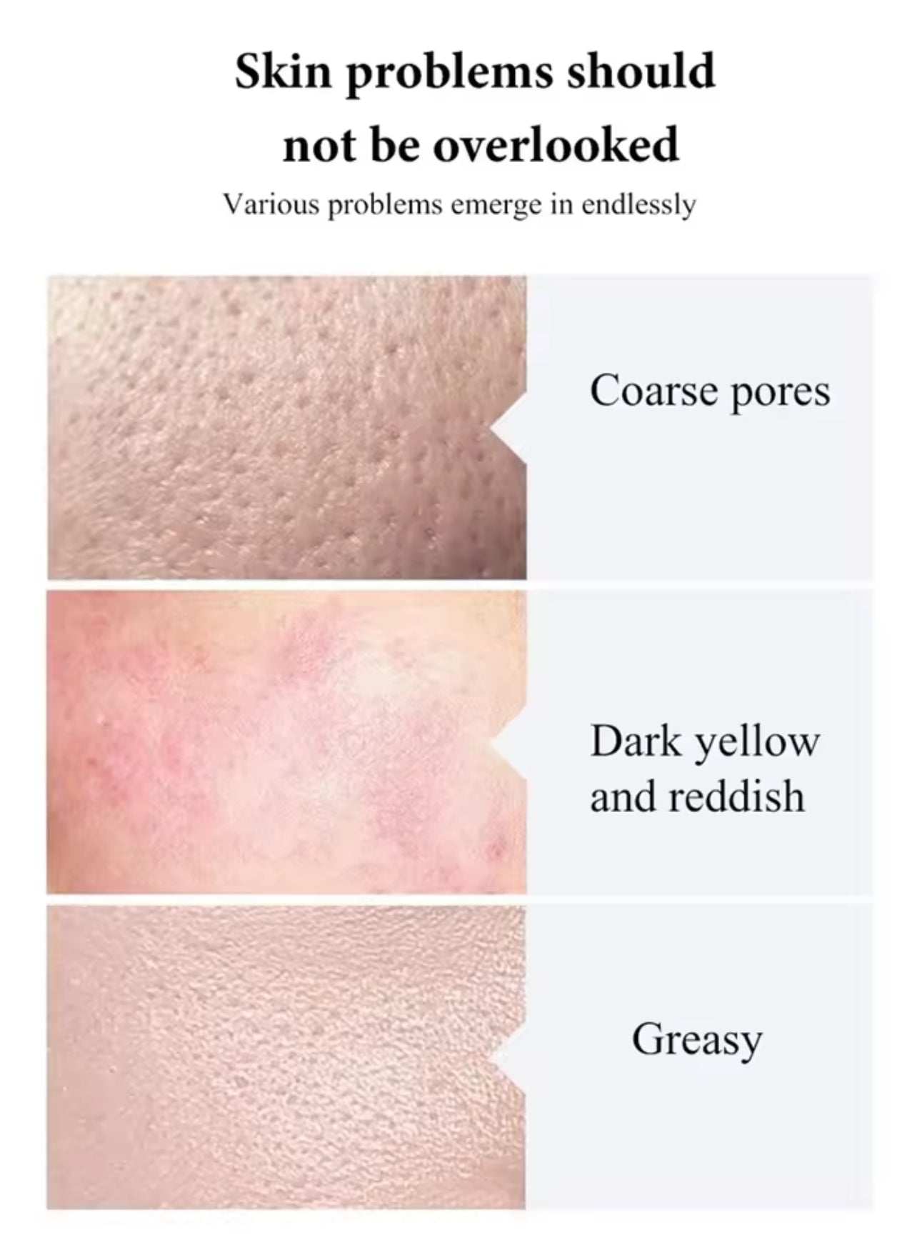 UltraWave Therapy with RF